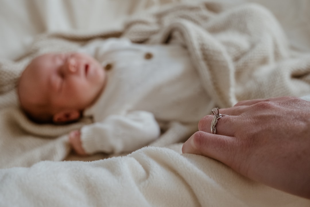 신생아 황달 강도 진행 머리부터 발끝까지